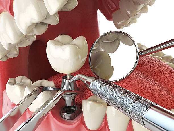 Best Emergency Root Canal Treatment in Navassa, NC